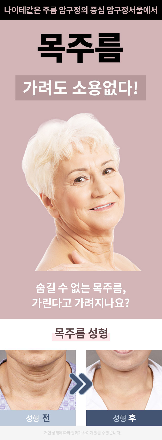 목주름_프로모션_페이지