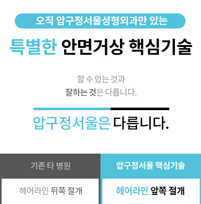 안면거상술_프로모션_페이지