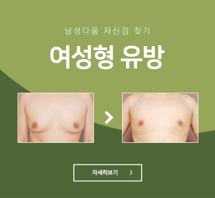 남여성형유방 - 남성다움 자신감 찾기