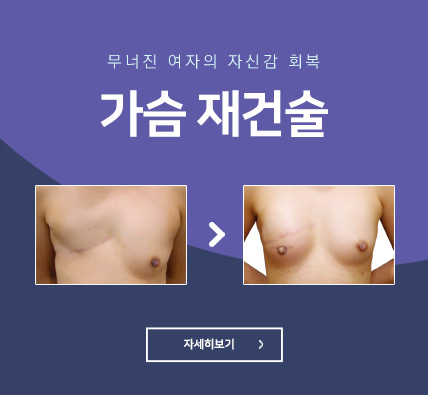 가슴재건 - 무너진 여자의 자신감 회복 