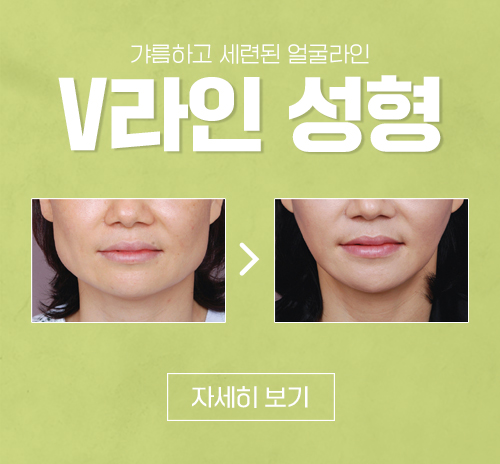 v라인