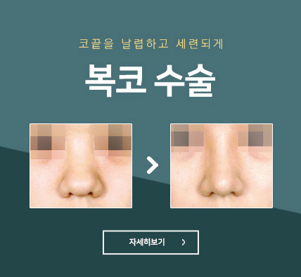 복코성형